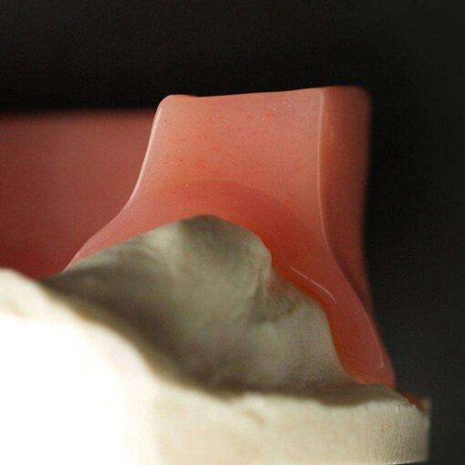 Versacryl Fitting & Bonding