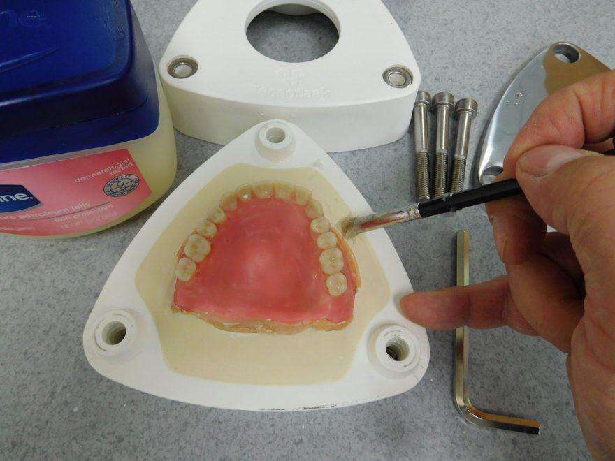 Efficiency and Accuracy in Denture Base Processing